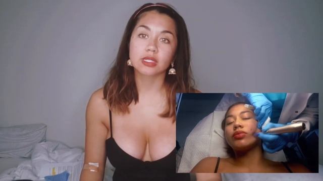PRP FACIALS & WHAT THEY DO TO YOUR SKIN