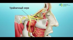 Воспаление тройничного нерва