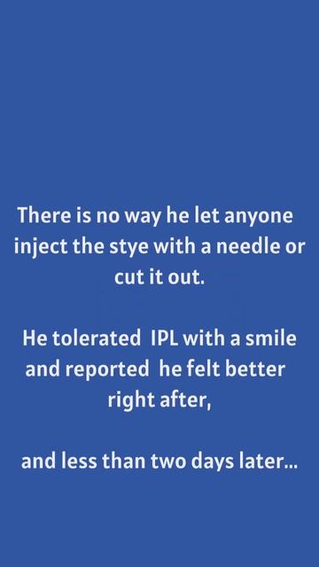 Two cases of speedy recover of styes after one session of IPL, with Before & After photos смотреть онлайн