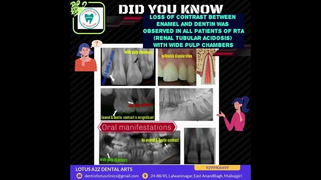 How Dental Professionals Can Detect Renal Tubular Acidosis (RTA) Early | Key Oral Signs to Look For
