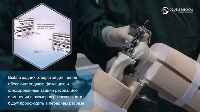 Cynthia Knee System bone model operation смотреть онлайн