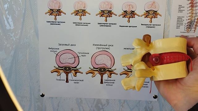 პროტრუზია, თიაქარი смотреть онлайн