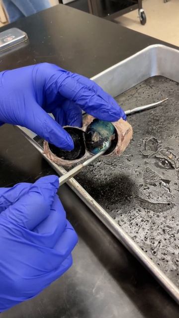 Dissection of the cow eye смотреть онлайн