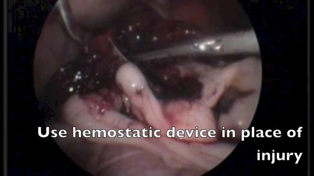 Laparoscopic hemostasis after splenic trauma in a cat смотреть онлайн