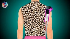 Relaxing Asmr Animation | Treatment & Cleaning | Asmr Care | Royal Asmr |