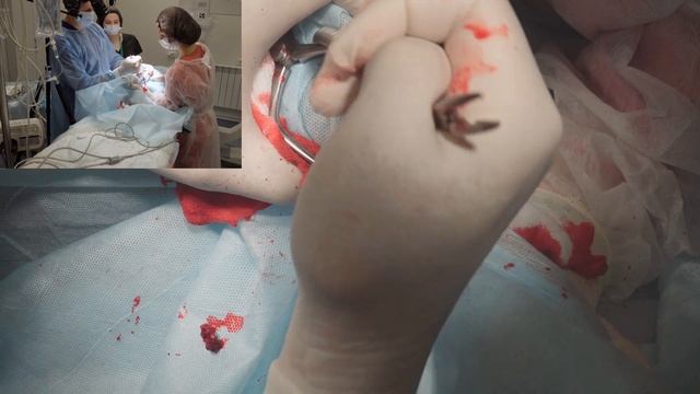 Дистальная остеотомия8к смотреть онлайн