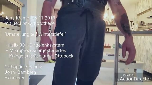 Helix 3D Hüftgelenksystem  Ottobock DE