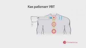 Ударно-волновая терапия заболеваний позвоночника