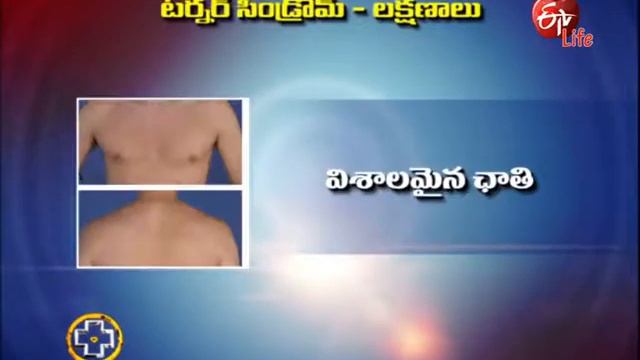 Aarogyamastu | Tumer Syndrome | 11th November 2016 | ఆరోగ్యమస్తు смотреть онлайн
