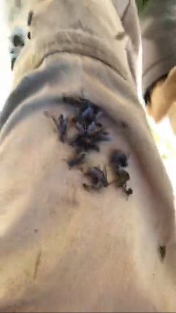 насекомые на ноге смотреть онлайн