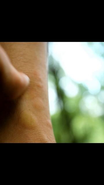 Nyamuk: Penghuni Tersembunyi di Sekitar Kita смотреть онлайн