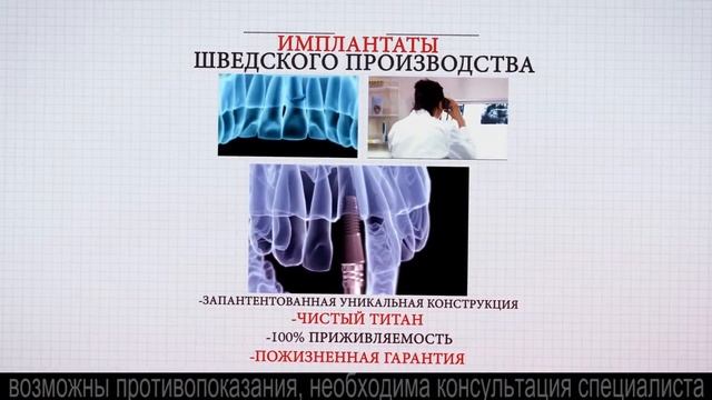 Стоматология Galadent. Шведские имплантанты. смотреть онлайн