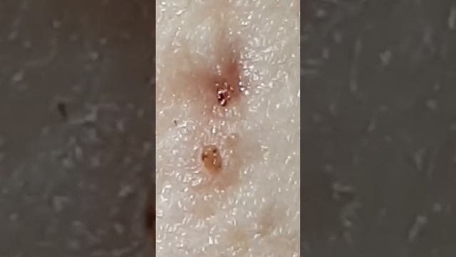 Nido de Tunga 2 смотреть онлайн