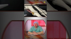 Операция "Hallux Valgus"