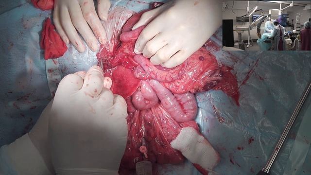 Шунт внутри печени у собаки смотреть онлайн