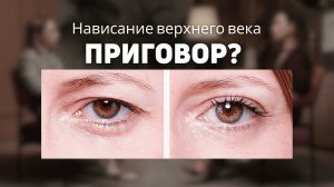 Нависание верхнего века - ПРИГОВОР? / Как избавиться от верхнего века без операций