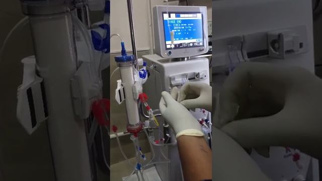 Priming of NIPRO Surdial 55 plus Hemodialysis machine. смотреть онлайн