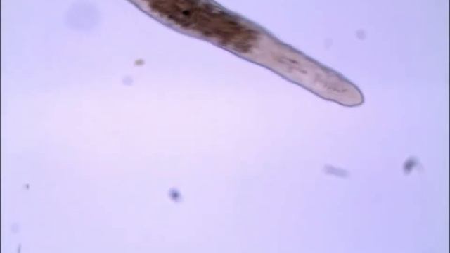 Stenostomum in action смотреть онлайн