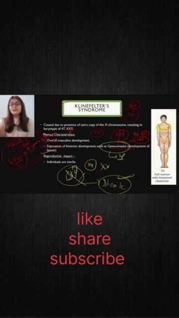 Trick to remember klinfelters and Turners Syndromeneet2024cuetaiimsbiologytricksgeneticscbs