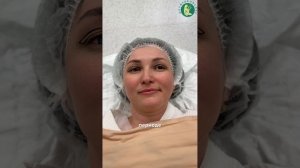 Кадры с операции: верхняя блефаропластика