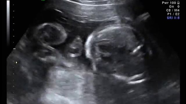 VTS 01 1 convert video online com смотреть онлайн