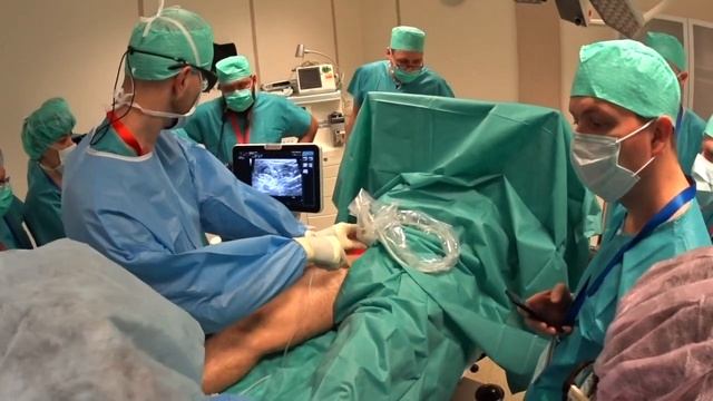 Эндовазальная лазерная коагуляция большой подкожной вены ("Турбо-Лазер"). смотреть онлайн