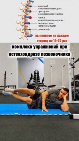 комплекс упражнений при остеохондрозе позвоночника