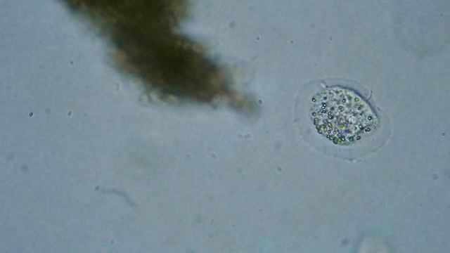 Amoeba Cochliopodium with Cytoplasmic Crystals смотреть онлайн