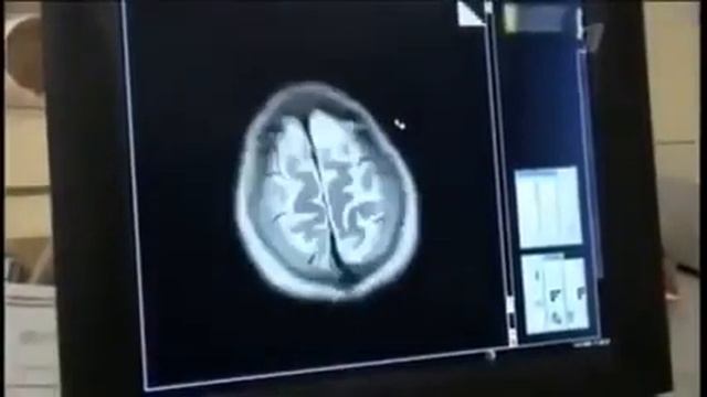 О страшном вреде электромагнитного излучения ссылка на место экспертизы