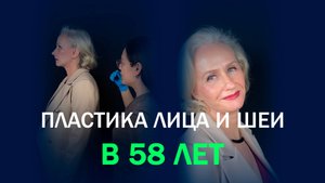 Лицо без следов операции: история Натальи после смас-лифтинга
