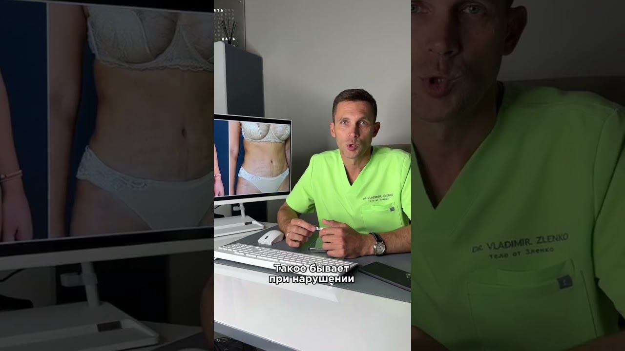 Работа над ошибками #липосакция