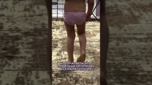 Ребёнок косолапит. Что делать?