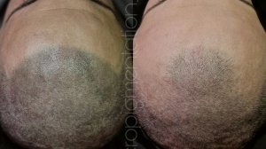 про Онлайн Обучение Трихопигментации