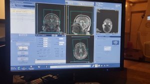 Brain MRI on the Signa Voyager