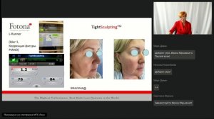 Вебинар 21.04.25. Протоколы Fotona "лицо под ключ" для пациентов 55+ лет