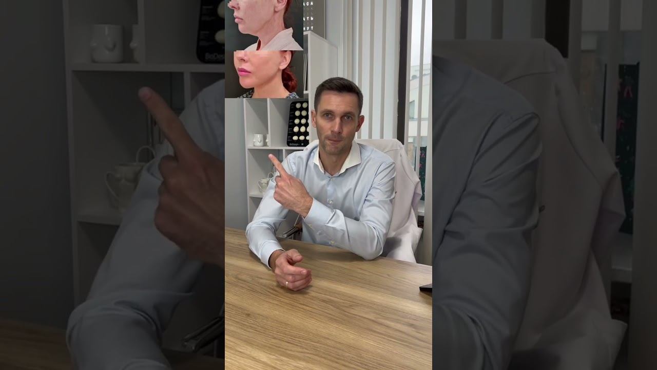 Как убрать второй подбородок? Два эффективных способа