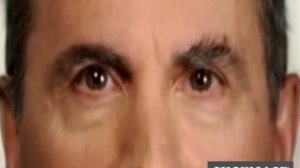 MicroTouch Switchblade‬ مكينة الحلاقة لجميع الجسم للشراء 0551544329