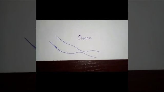 Qizilo'ngach divertikulasi.Дивертикула пищевода смотреть онлайн