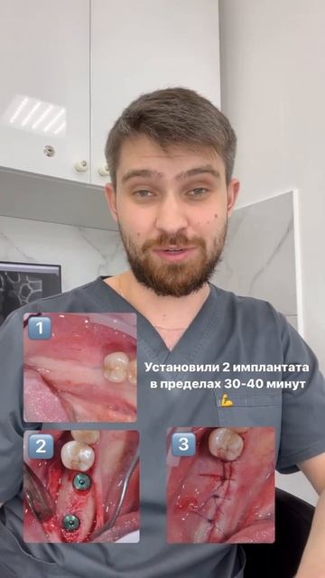 2 имплантата за 30 минут 🔥 #стоматологмосква #стоматолог смотреть онлайн