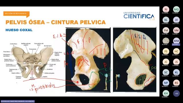 SESIÓN 8 - parte 01 (29/10/2023) - Pelvis parietal, pelvis ósea, pelvimetría y perineo смотреть онлайн
