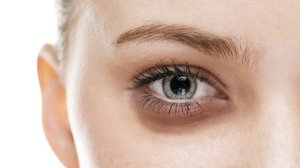 Как убрать круги под глазами