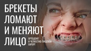 Правда ли, что кости черепа и лицевые кости МЕНЯЮТСЯ при ортодонтическом лечении?