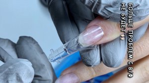 Больше проблем с верхними формами не будет