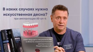 Дефицит костной ткани при All-on-4?