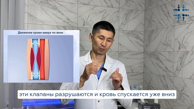 Почему варикозное расширение вен - это болезнь цивилизации? Отвечает врач-флеболог