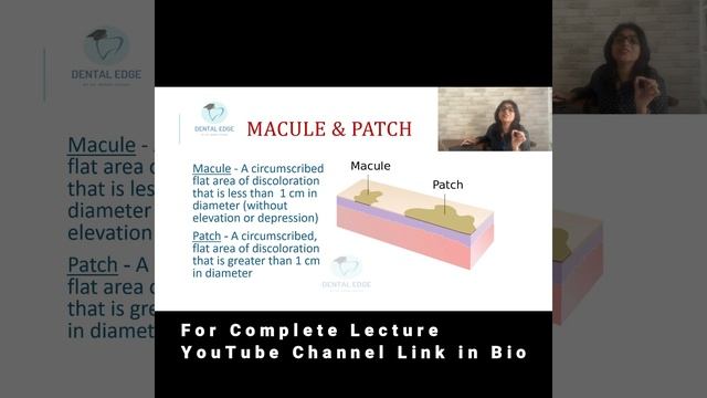SKIN DISEASES I MACULE I PATCH I ORAL PATHOLOGY #shorts смотреть онлайн