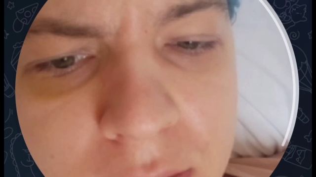 СОСТОЯНИЕ ПЯТЁРКИ ПОСЛЕ ОПЕРАЦИИ! С НИМ ВСЁ ХОРОШО?