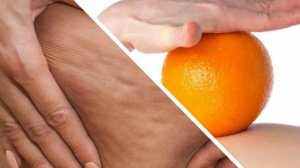 Как убрать целлюлит