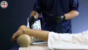Протокол применения высокоинтенсивного лазера 4CLINIC для лечения тендинопатии ахилова сухожилия