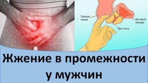 Жжение в промежности у мужчин
